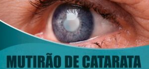 Read more about the article Mutirão de cirurgias de catarata inicia dia 29 de agosto